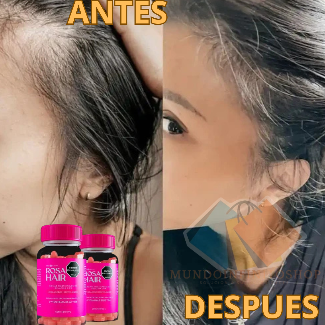 Rosa Hair™ Gomitas