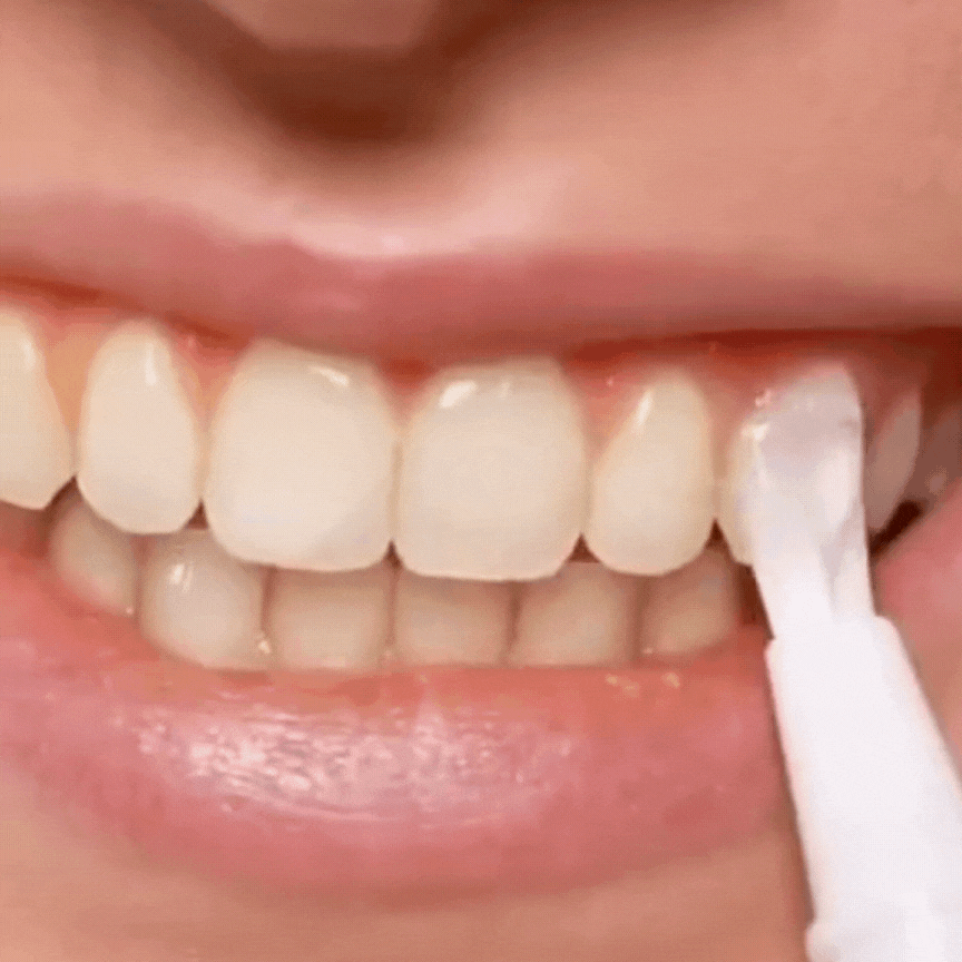 BrightSmile Pen™