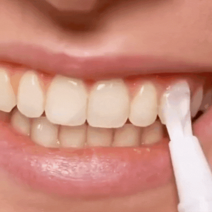 BrightSmile Pen™